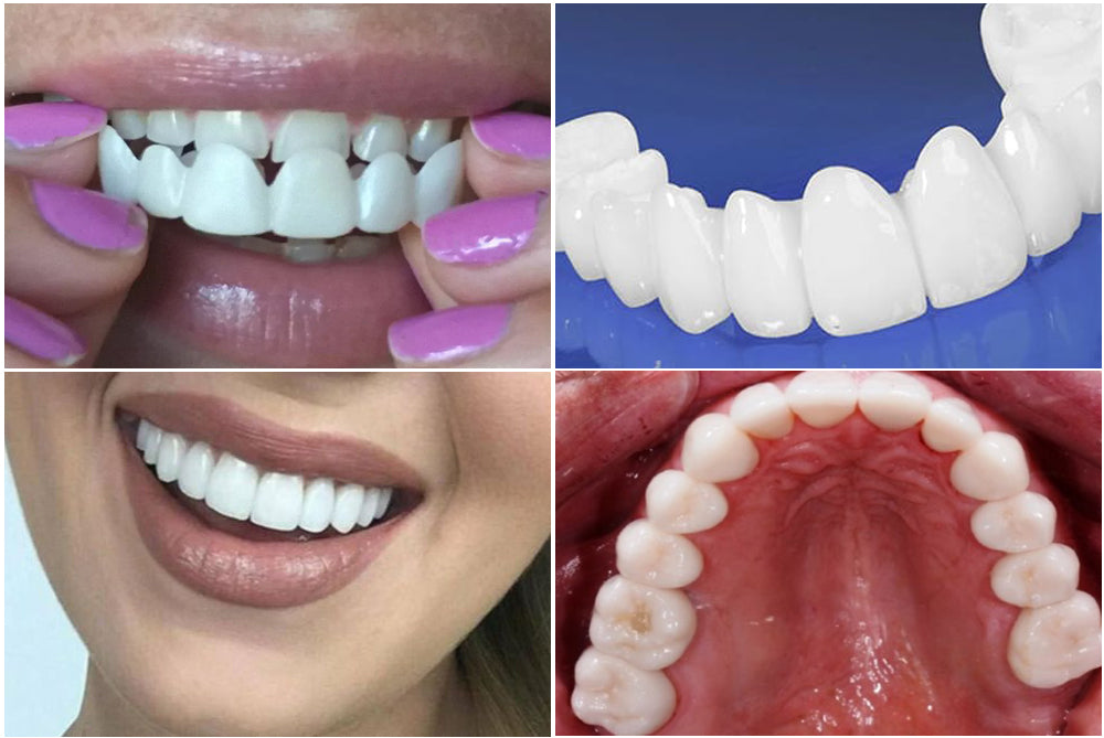 Upravitelné zubní čočky Kup 1, Získejte 2 Marlene Cz Dente